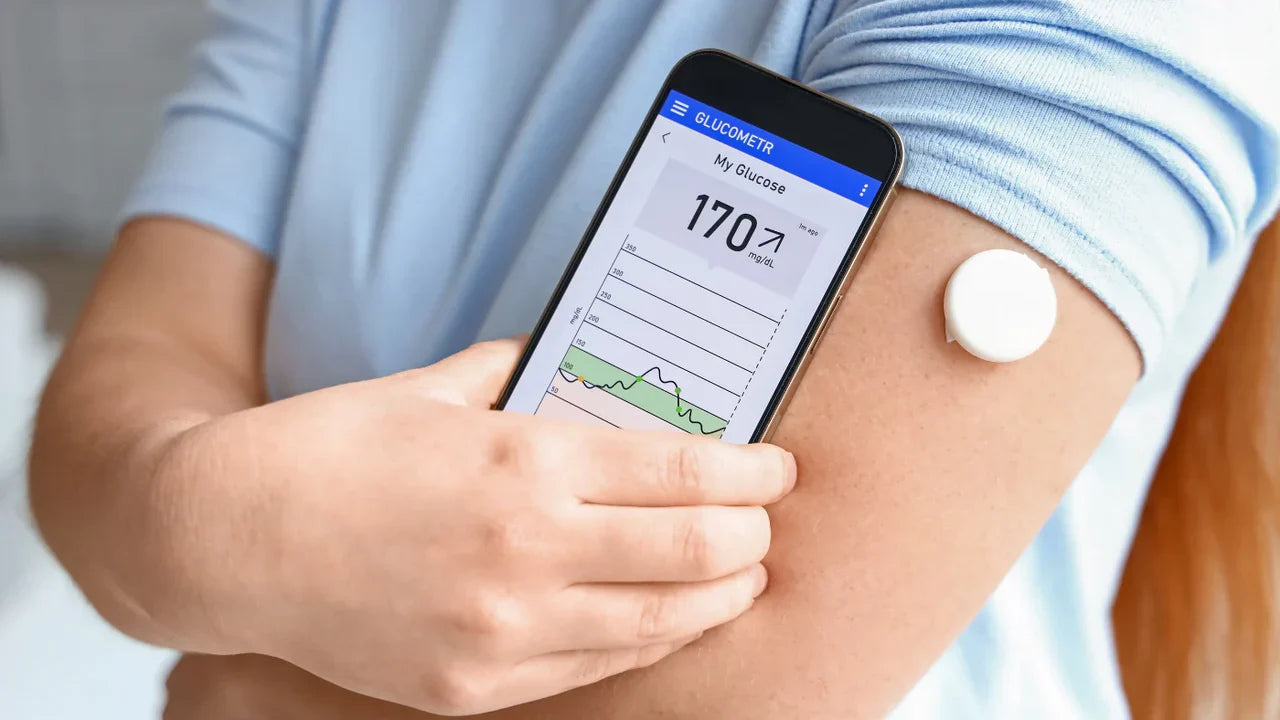 Person holding a smartphone showing a glucometer app reading 170 mg/dL next to a continuous glucose monitor sensor worn on their upper arm, representing 15-day glucose monitoring