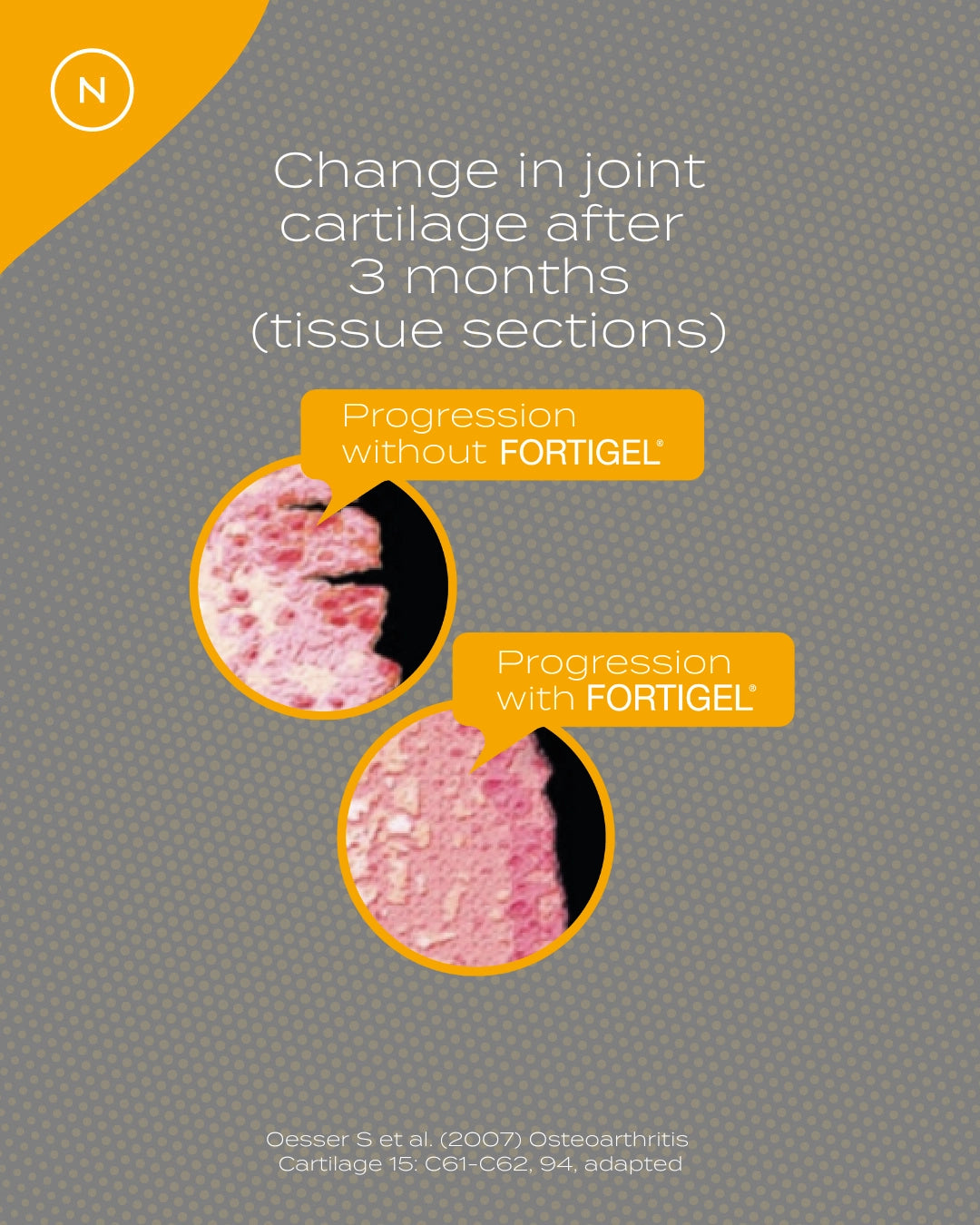 Collagen Peptides